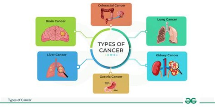 What type of cancer is most likely to recur?